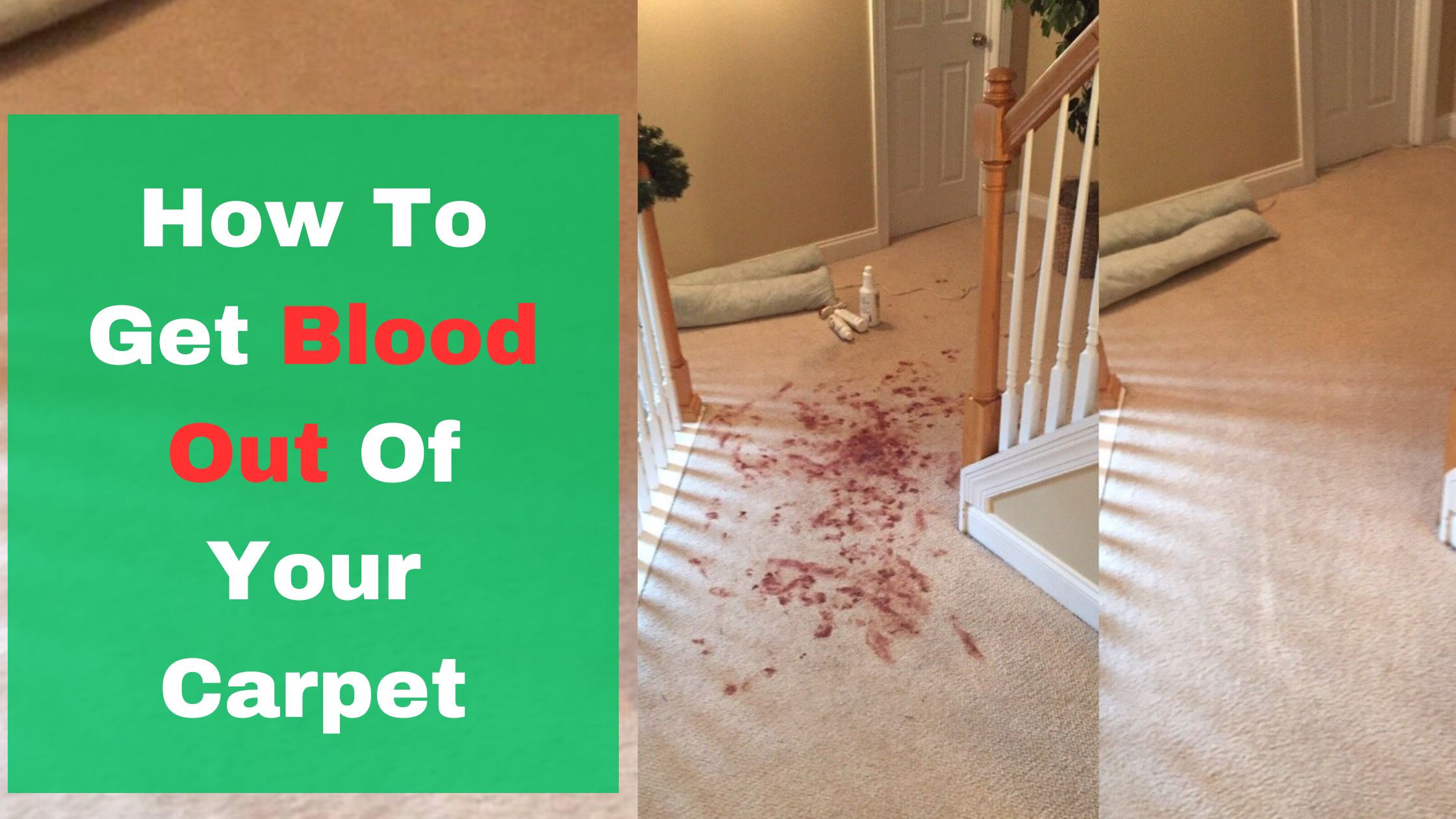 How To Get Blood Out Of Your Carpet 1 Stain Removal Solutions